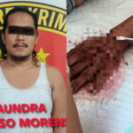 Sebelah kiri, Sopir berinisial PR berhasil diamankan Polsek Keluang. Sebelah kanan, tangan korban yang mengalami luka oleh senjata tajam pelaku. Fhoto: Istimewa