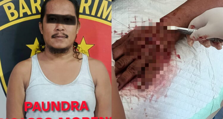 Sebelah kiri, Sopir berinisial PR berhasil diamankan Polsek Keluang. Sebelah kanan, tangan korban yang mengalami luka oleh senjata tajam pelaku. Fhoto: Istimewa