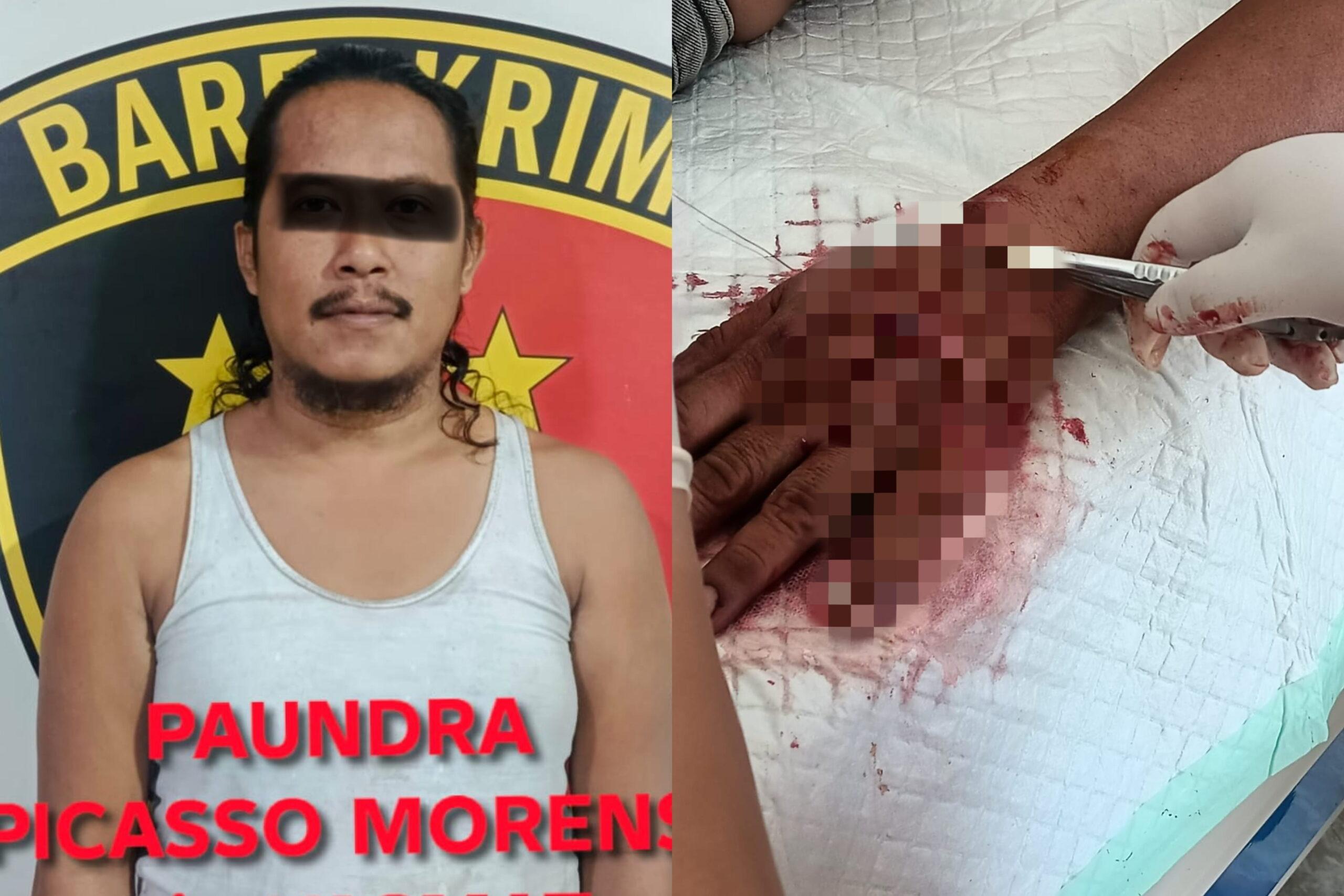 Sebelah kiri, Sopir berinisial PR berhasil diamankan Polsek Keluang. Sebelah kanan, tangan korban yang mengalami luka oleh senjata tajam pelaku. Fhoto: Istimewa